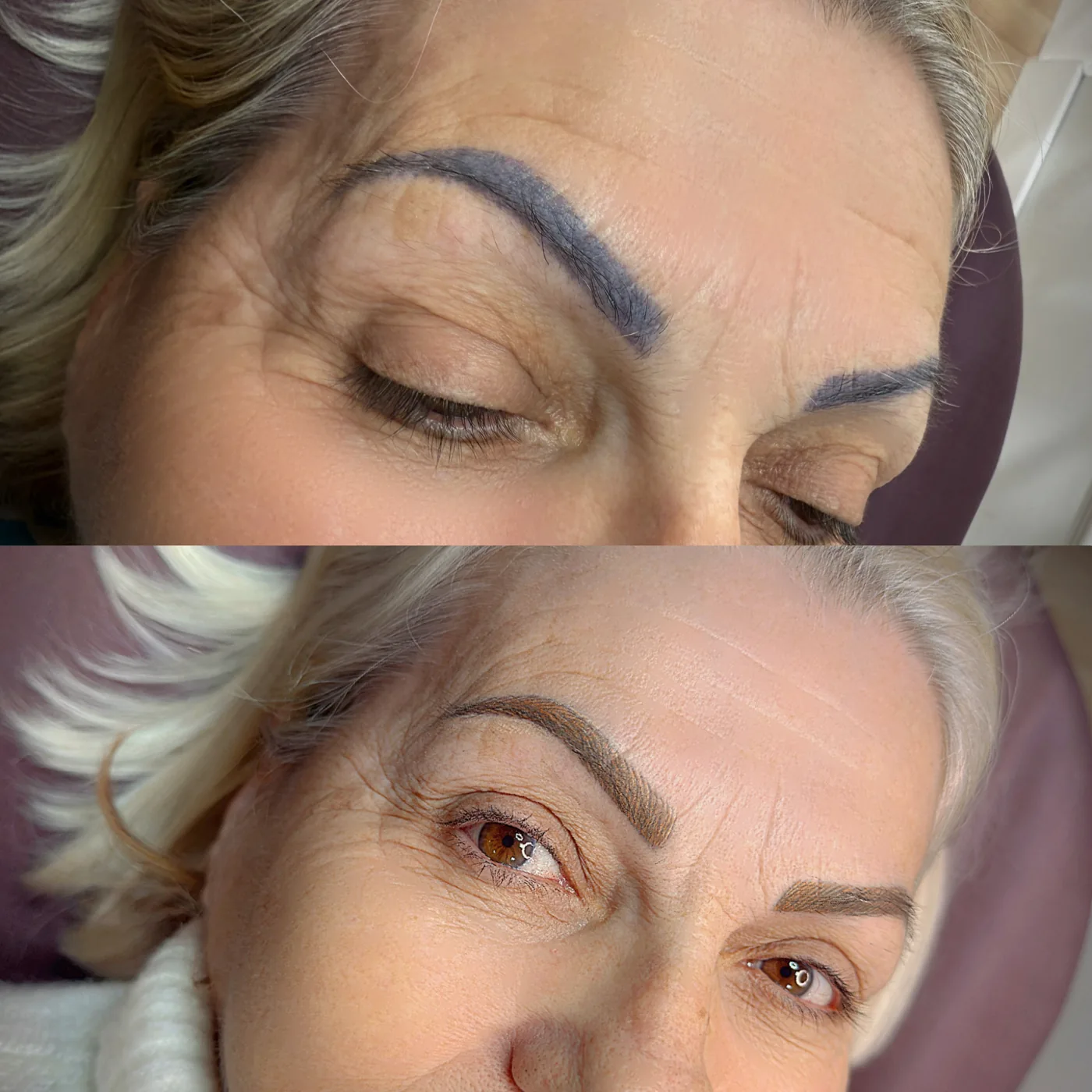 Comparativo antes e depois de sobrancelha